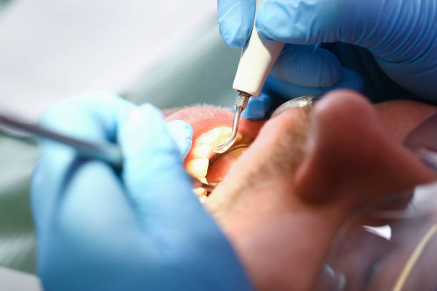 Best Holiday Emergency Dentist in Pigeon Forge, TN