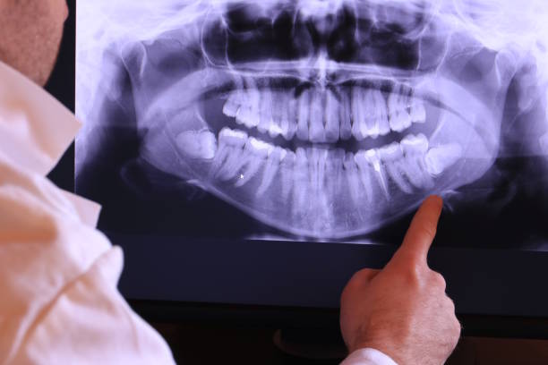 Best Emergency Dental Services for Seniors in Pigeon Forge, TN