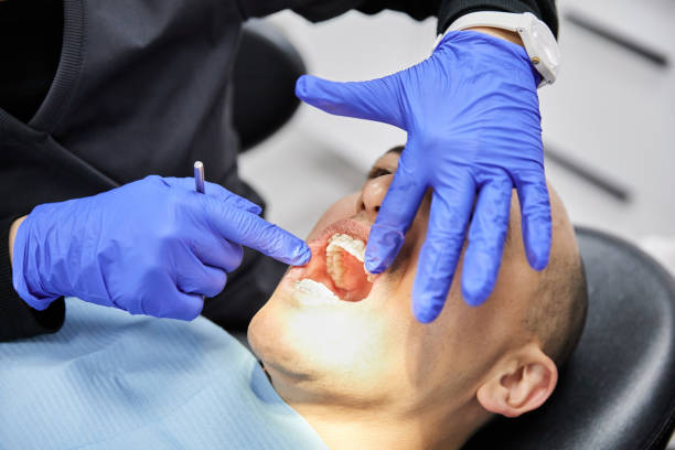 Best Emergency Root Canal Treatment in Pigeon Forge, TN